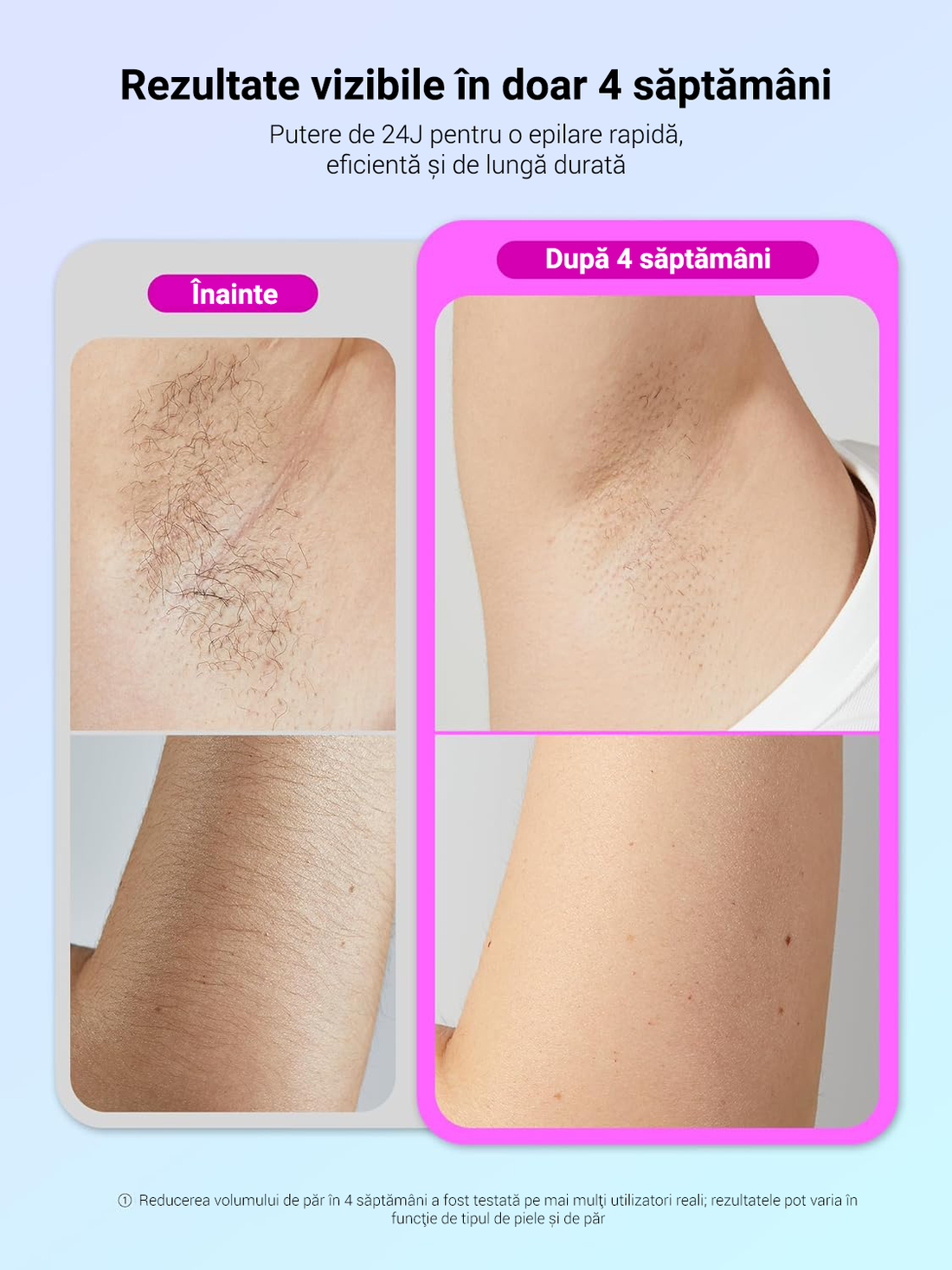 Epilator IPL